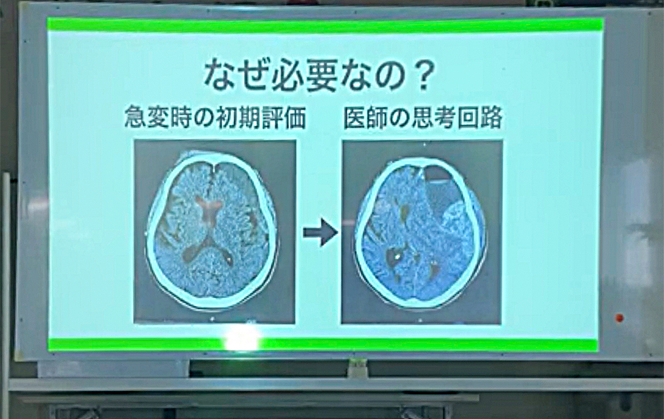 脳外科病棟での取り組み